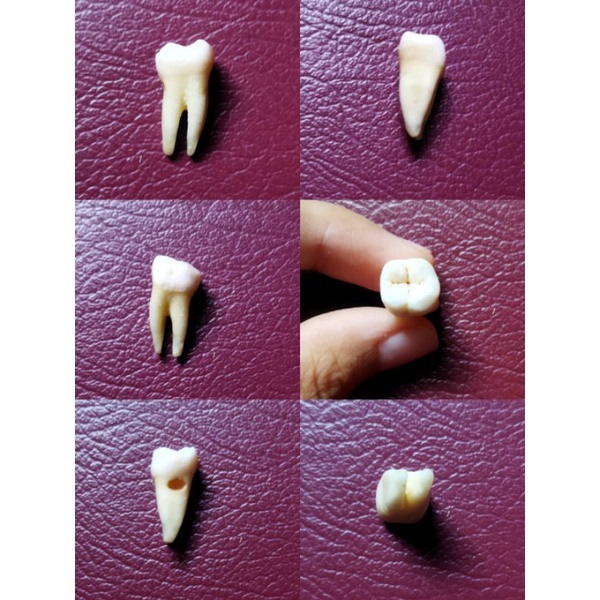 Detail Gambar Gigi Molar Nomer 6