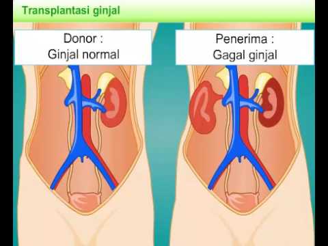 Detail Gambar Ginjal Animasi Nomer 48