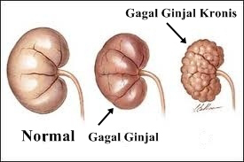 Detail Gambar Ginjal Animasi Nomer 52