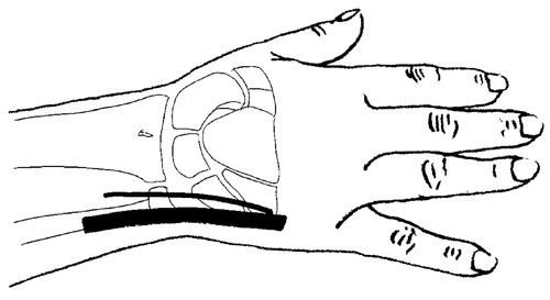 Detail M Extensor Carpi Radialis Longus Nomer 13