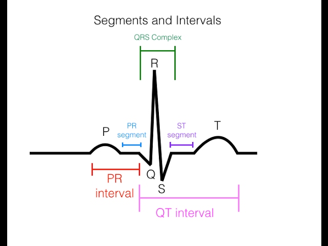 Detail Gambar Grafik Ekg Nomer 23