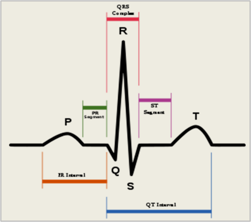 Detail Gambar Grafik Ekg Nomer 26