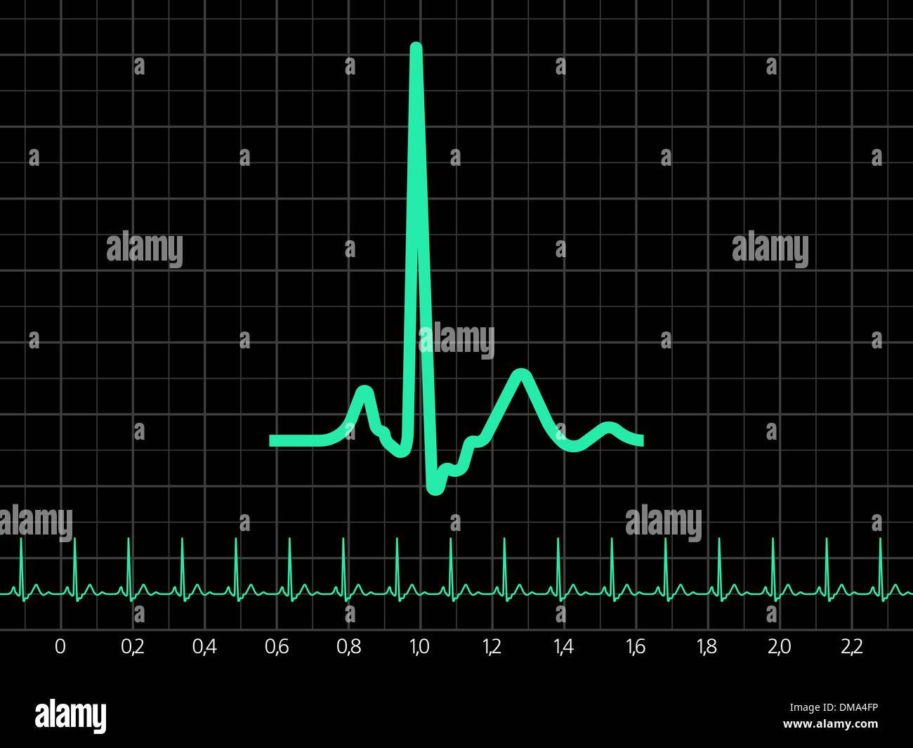 Detail Gambar Grafik Ekg Nomer 31