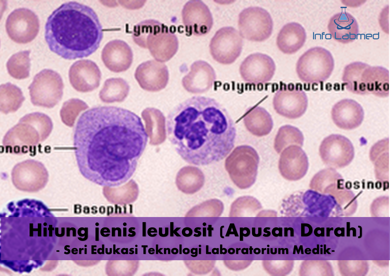 Detail Gambaran Darah Tepi Nomer 15