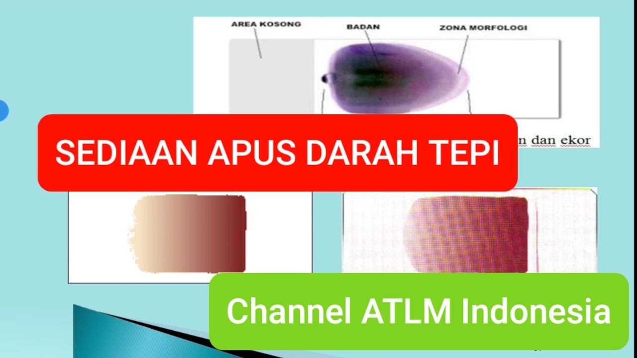 Detail Gambaran Darah Tepi Nomer 35