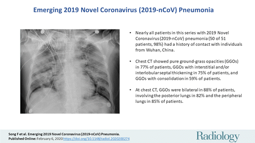 Detail Gambaran Radiologi Pneumonia Nomer 21