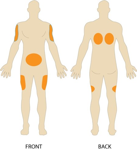 Detail Vitamin B12 Injektion Nomer 10