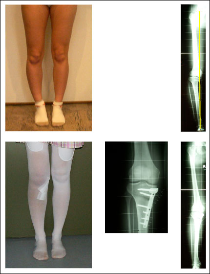 Detail Bursitis Knie Bilder Nomer 7