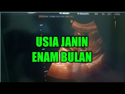 Detail Contoh Gambar Janin Usia 6 Bulan Nomer 4