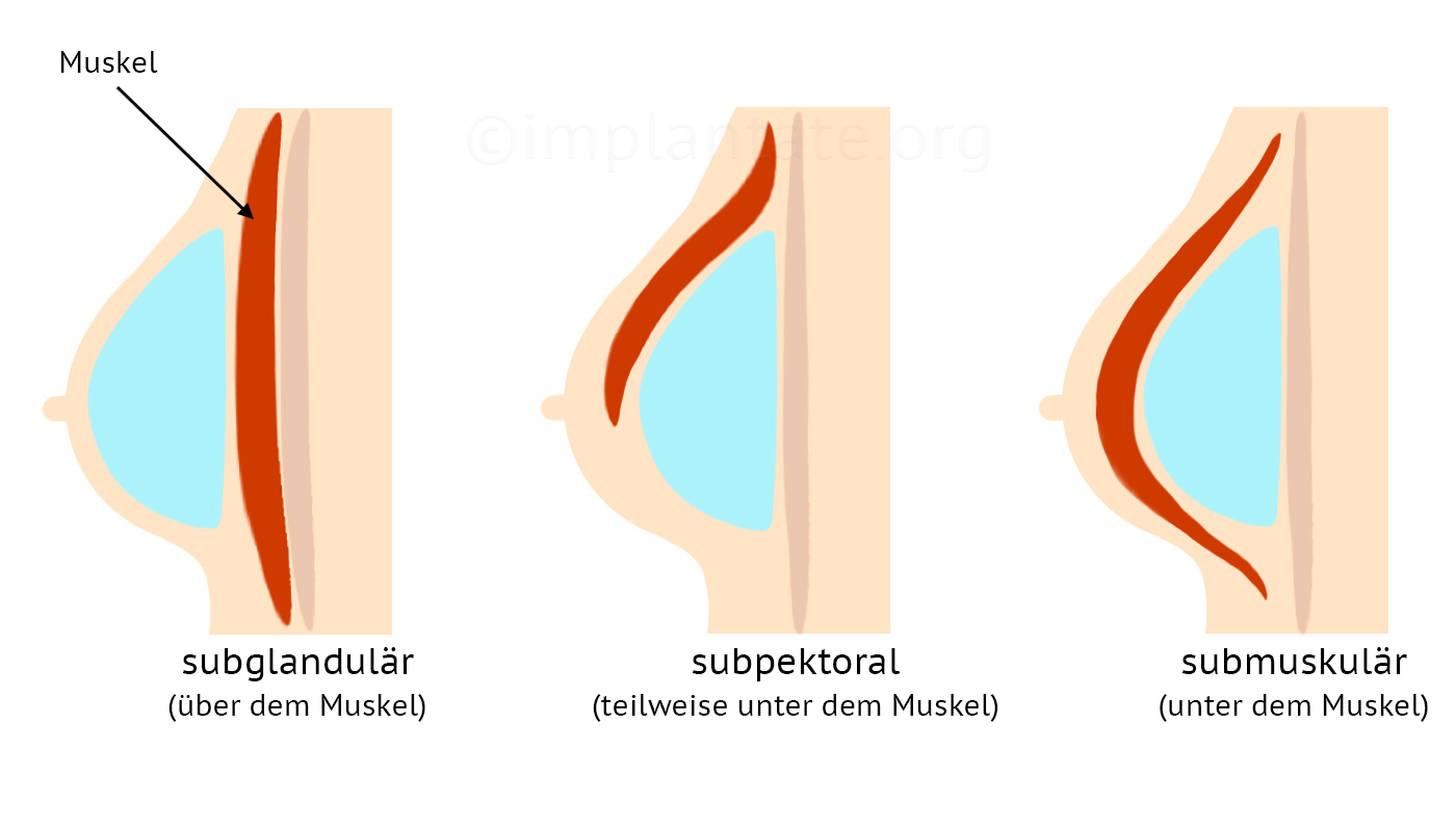 Detail Anatomie Der Brust Nomer 3