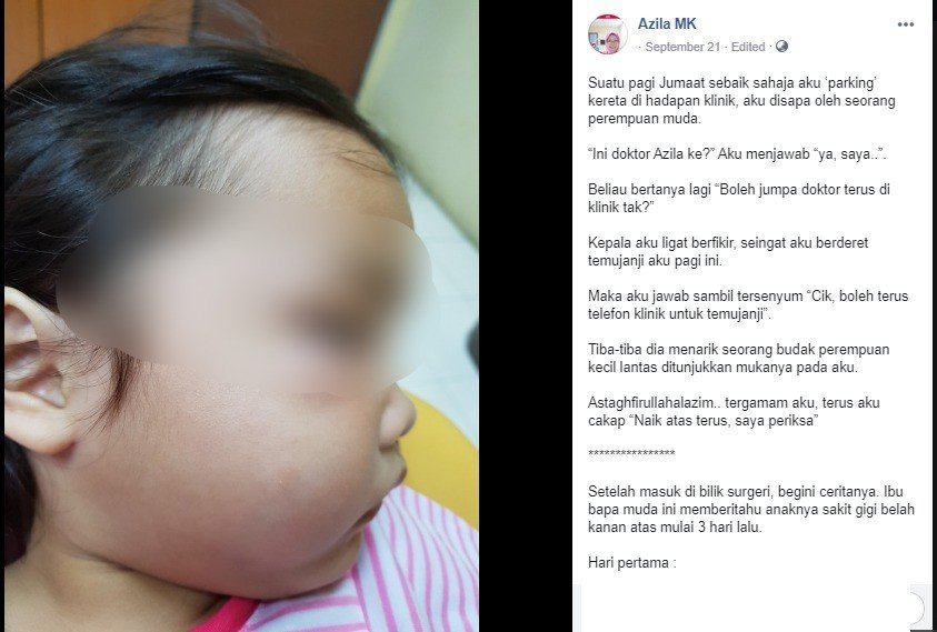 Detail Gambar Gusi Bengkak Pada Anak Nomer 30