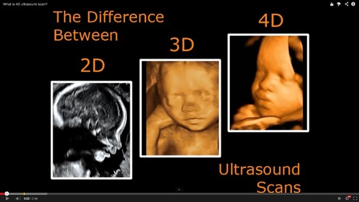 Gambar Hasil Usg 4 Dimensi - KibrisPDR