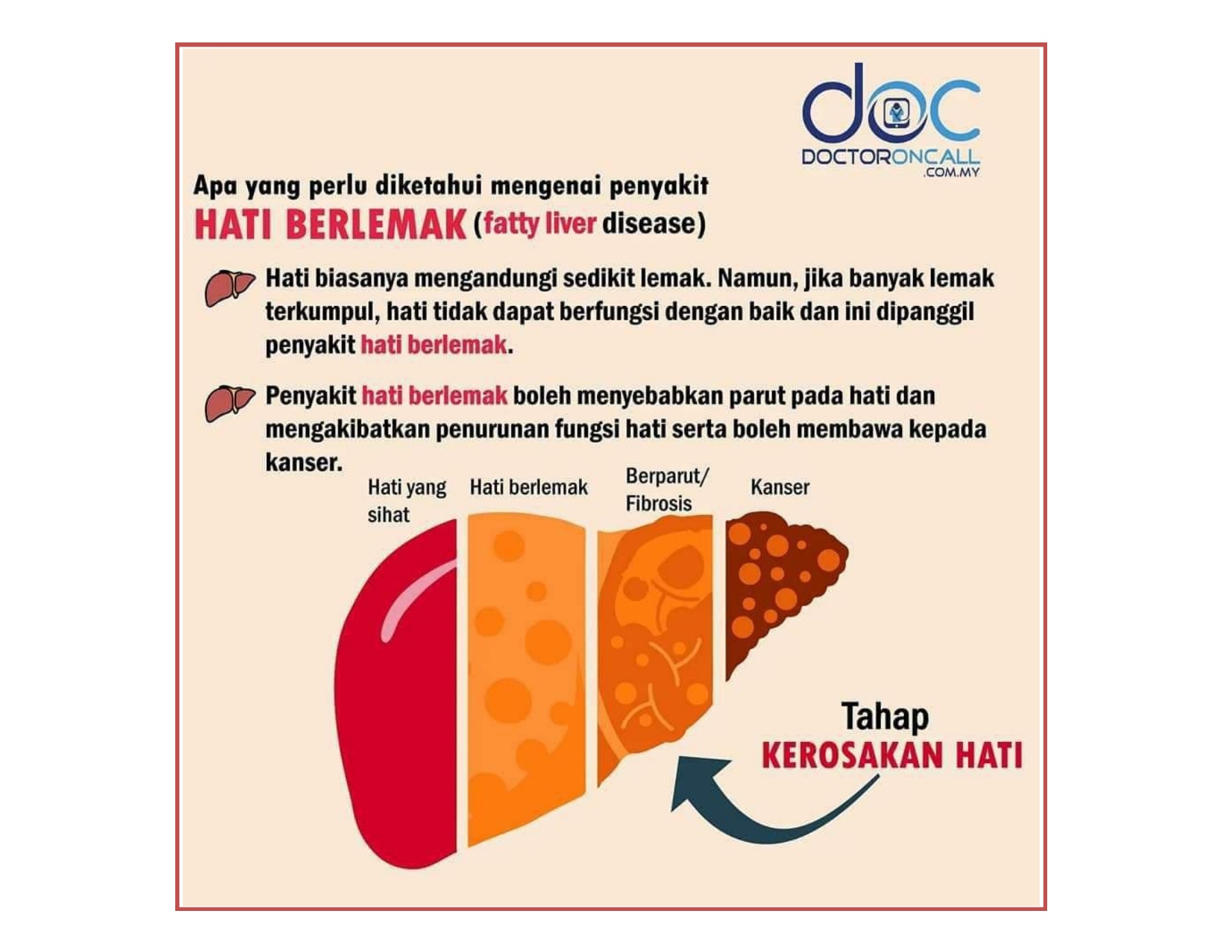 Detail Gambar Hati Berlemak Nomer 17