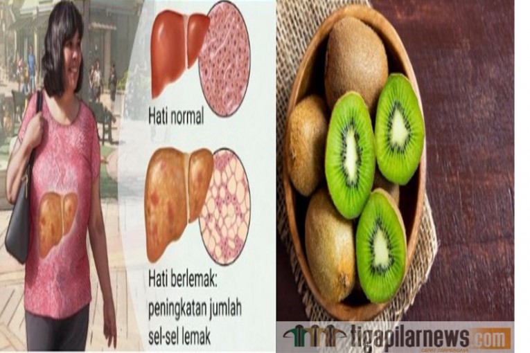 Detail Gambar Hati Berlemak Nomer 30