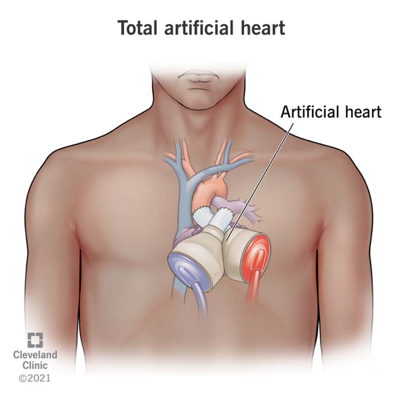 Detail Gambar Heart Nomer 26