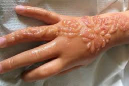 Detail Gambar Henna Anak Perempuan Nomer 29