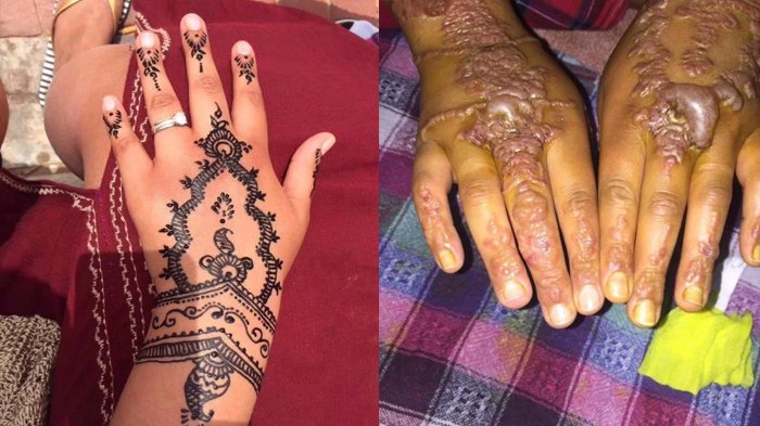 Detail Gambar Henna Cantik Nomer 35