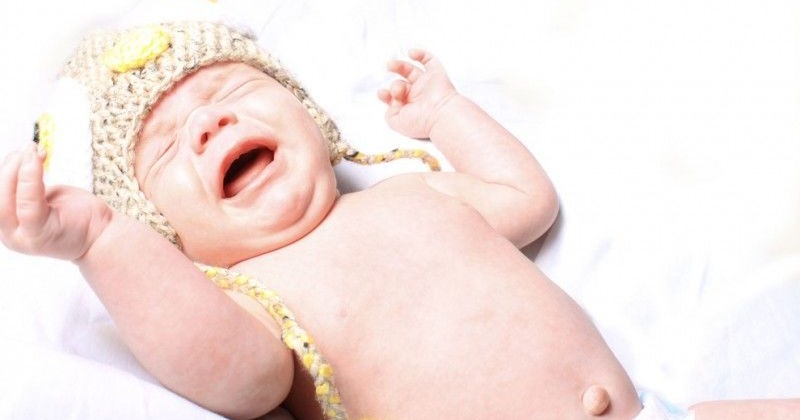 Detail Gambar Hernia Inguinalis Pada Bayi Nomer 43