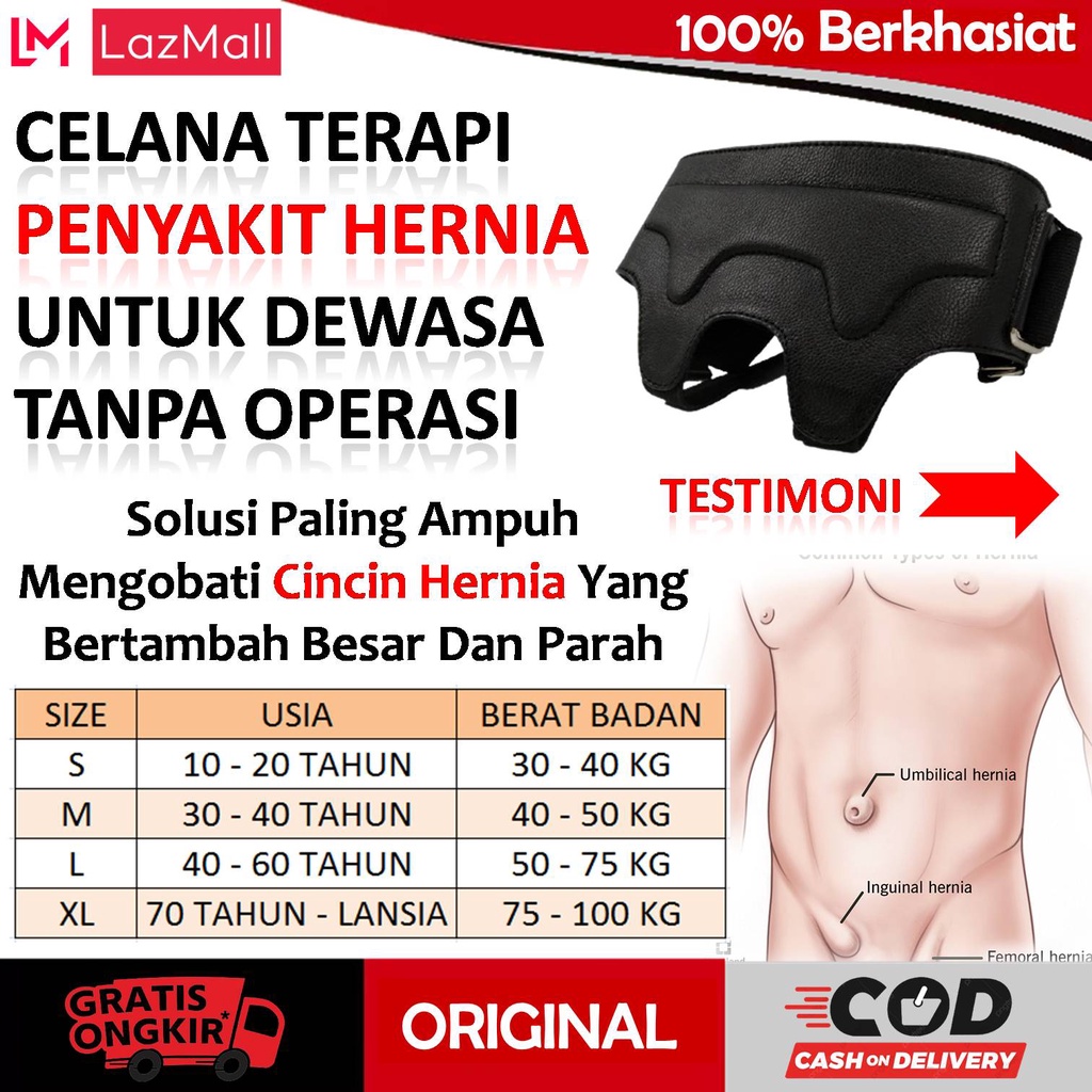 Detail Gambar Hernia Wanita Nomer 49