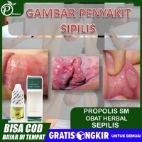 Detail Contoh Gambar Penyakit Sipilis Nomer 25