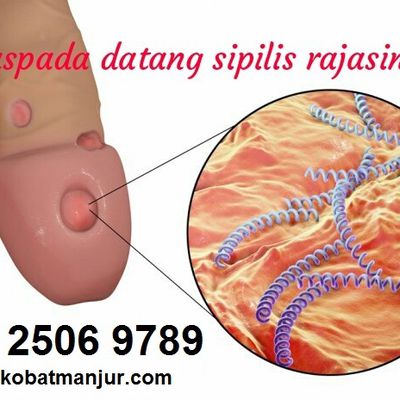 Detail Contoh Gambar Penyakit Sipilis Nomer 56