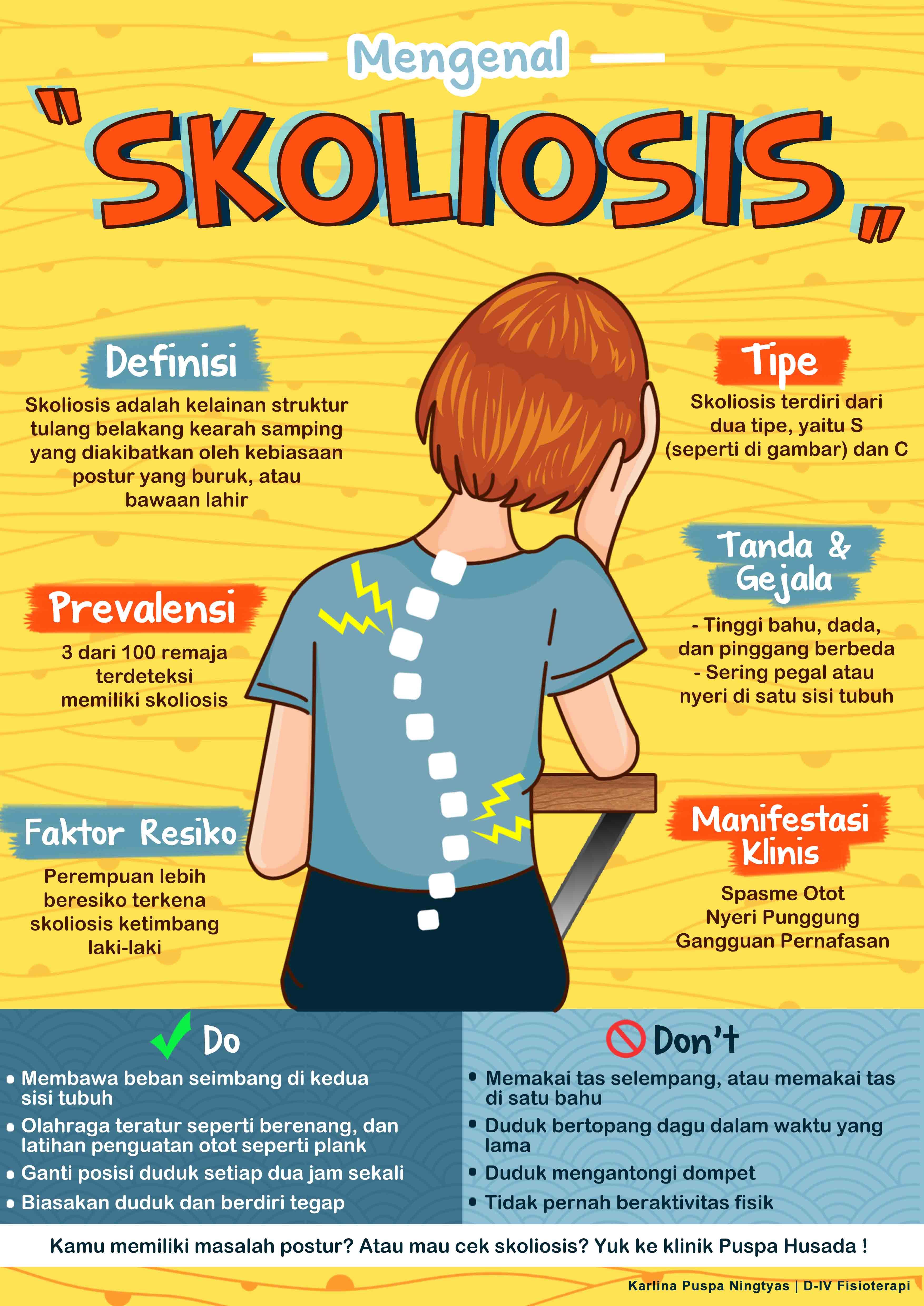 Detail Contoh Gambar Skoliosis Nomer 49