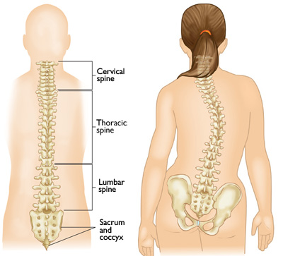 Detail Contoh Gambar Skoliosis Nomer 8
