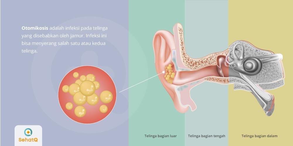 Detail Contoh Gambar Telinga Nomer 32