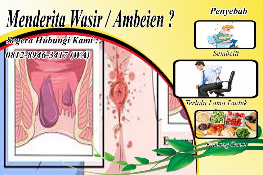 Detail Contoh Gambar Wasir Stadium 4 Nomer 13