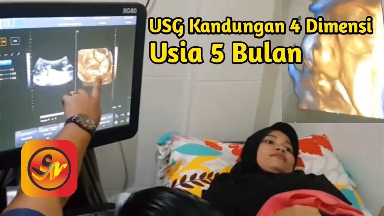 Detail Contoh Gerakan Janin Usia 5 Bulan Nomer 47