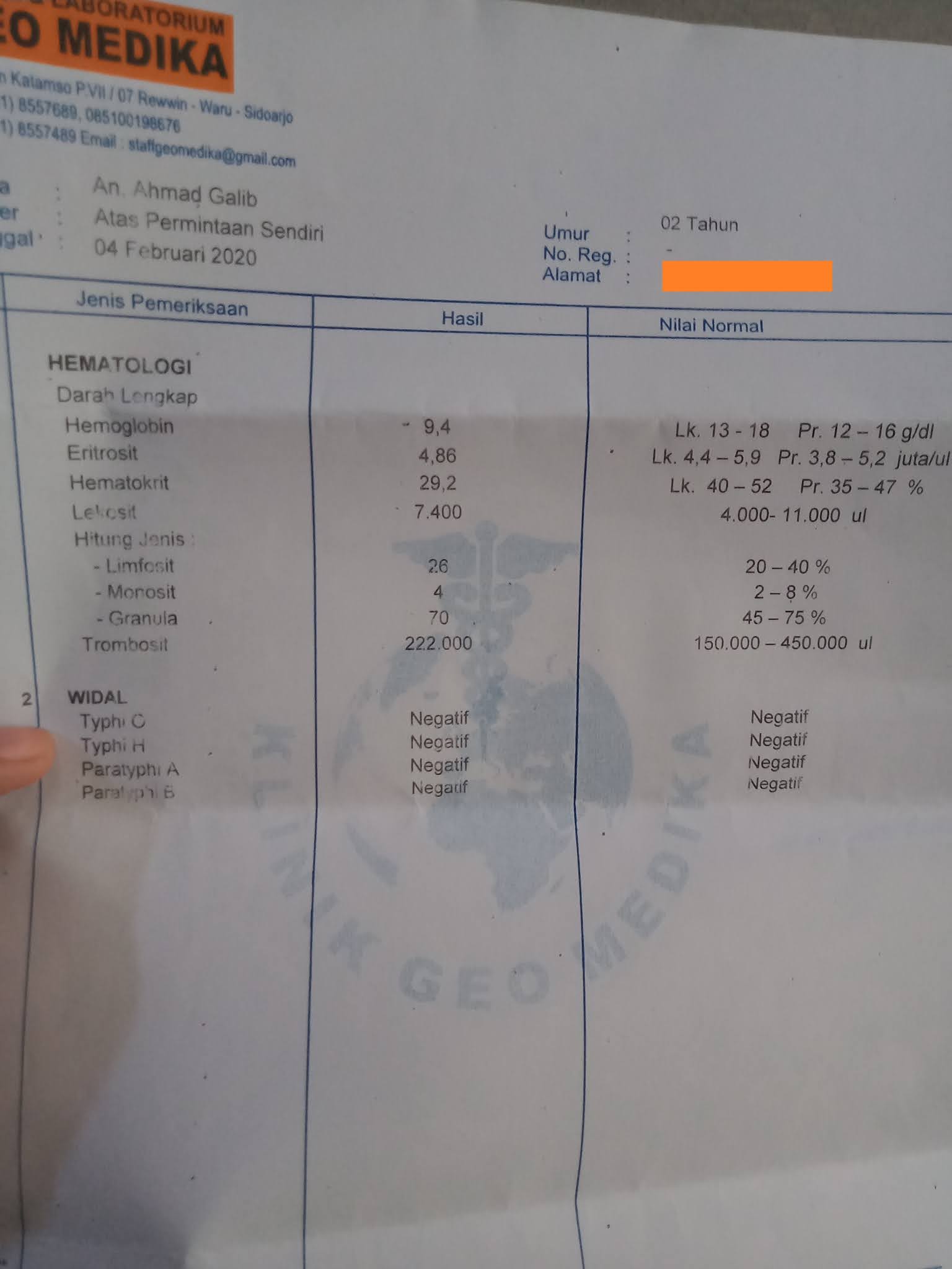 Contoh Hasil Cek Darah Positif Dbd - KibrisPDR