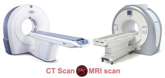 Detail Contoh Hasil Ct Scan Nomer 20