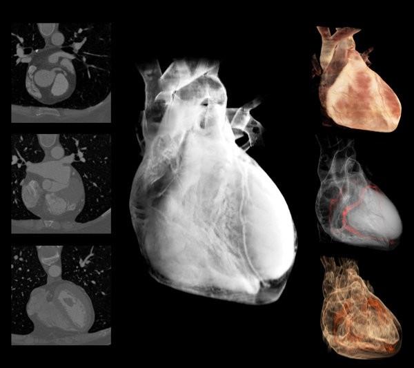 Detail Contoh Hasil Ct Scan Nomer 32