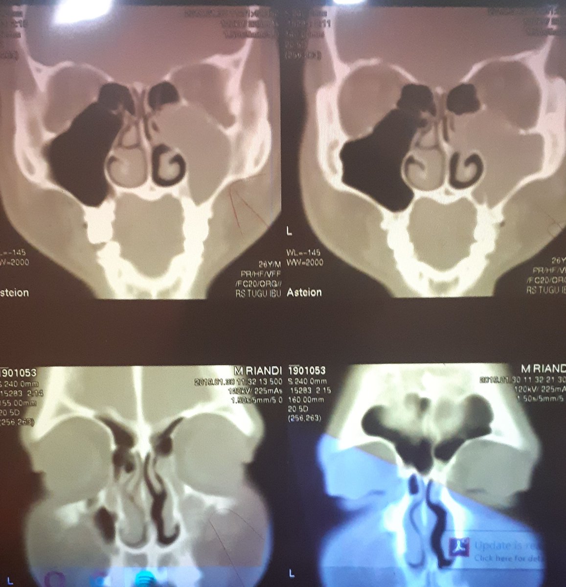 Detail Contoh Hasil Ct Scan Koleksi Nomer 33