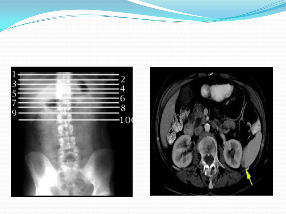 Detail Contoh Hasil Ct Scan Nomer 40