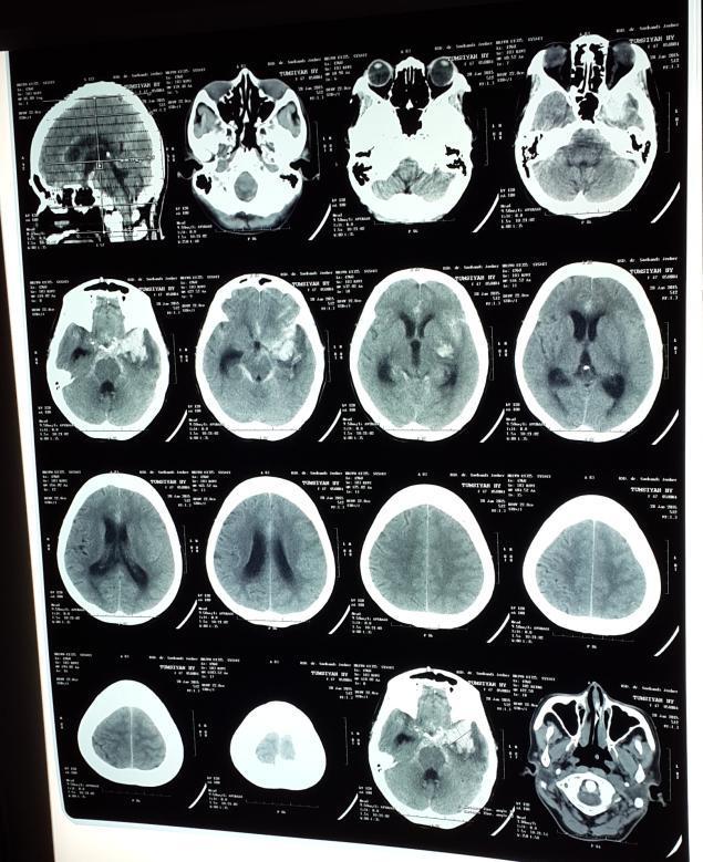 Detail Contoh Hasil Ct Scan Koleksi Nomer 42