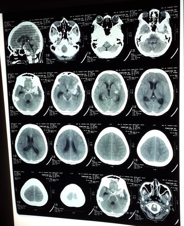 Detail Contoh Hasil Ct Scan Nomer 42