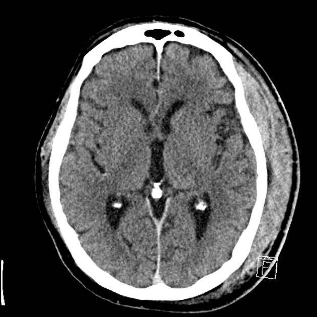 Detail Contoh Hasil Ct Scan Nomer 43