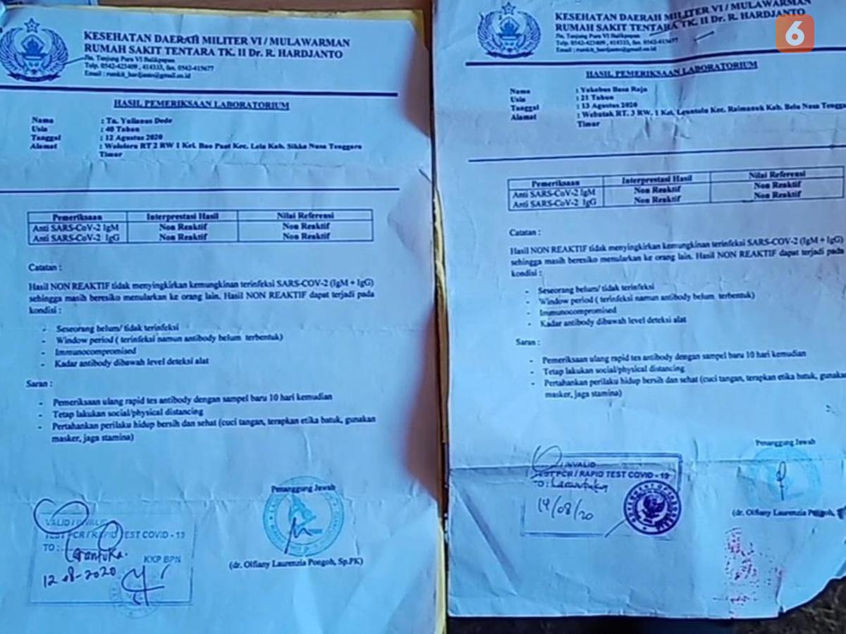 Detail Contoh Hasil Rapid Test Antigen Nomer 35