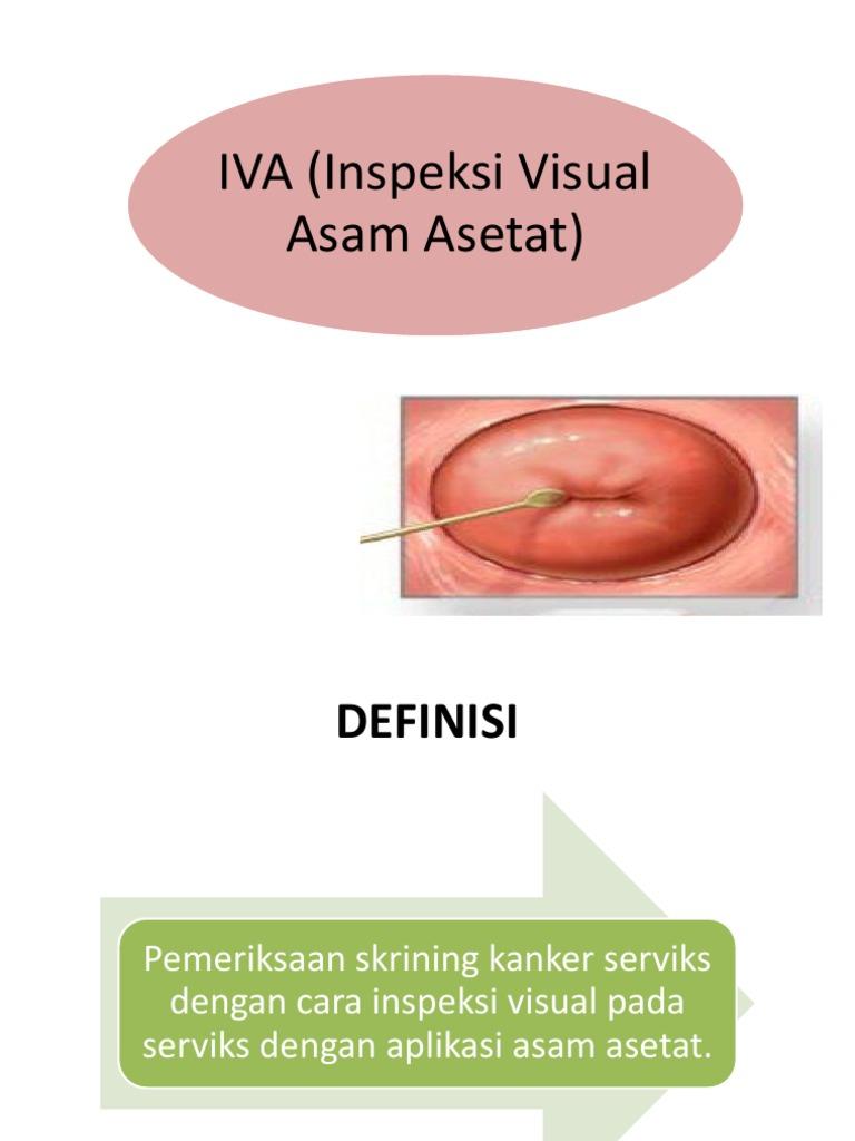 Detail Contoh Hasil Tes Iva Nomer 6