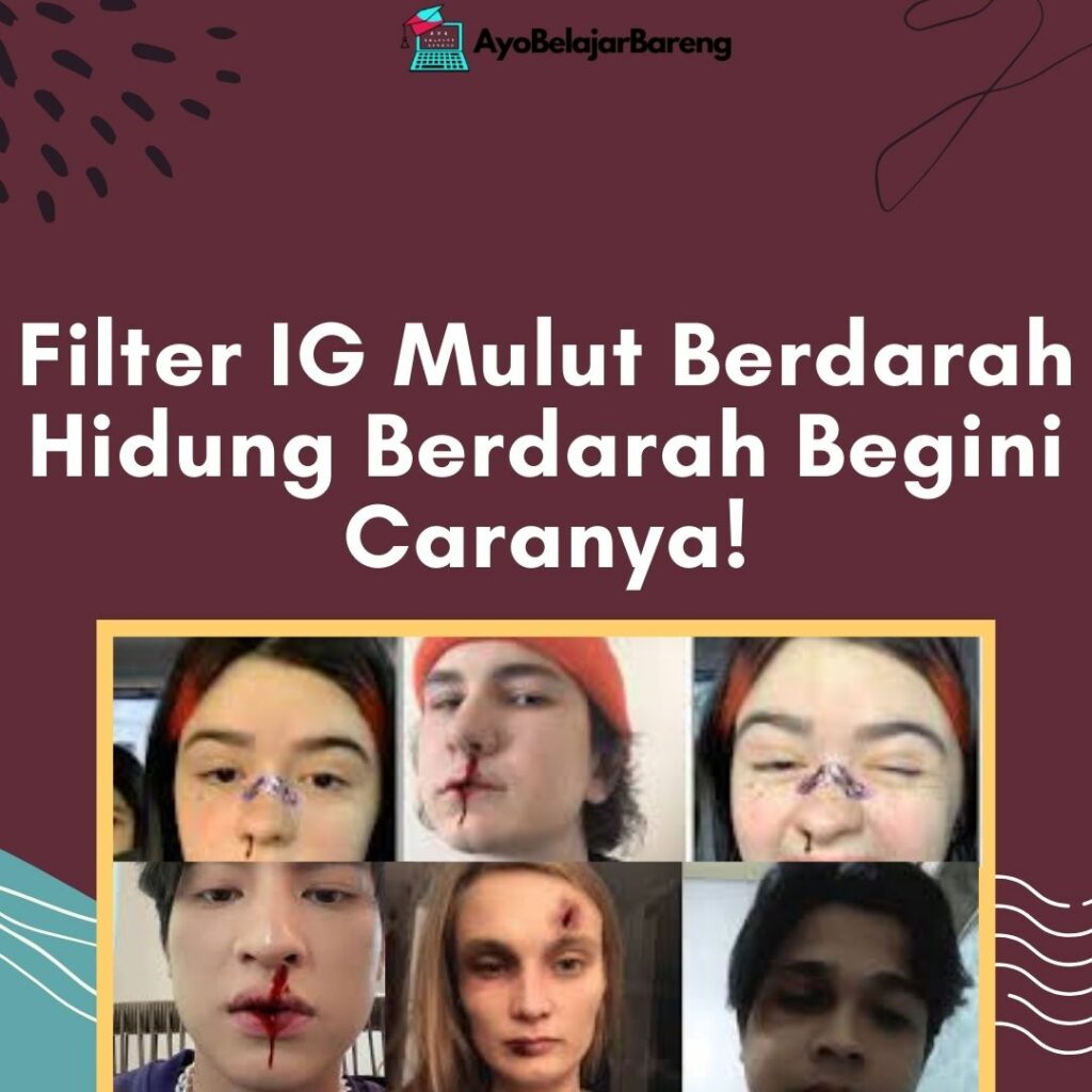 Detail Gambar Hidung Berdarah Nomer 57