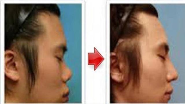 Detail Gambar Hidung Mancung Dan Pesek Nomer 4