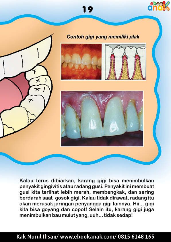 Detail Gambar Ibu Kartun Gambar Kuman Gigi Nomer 44