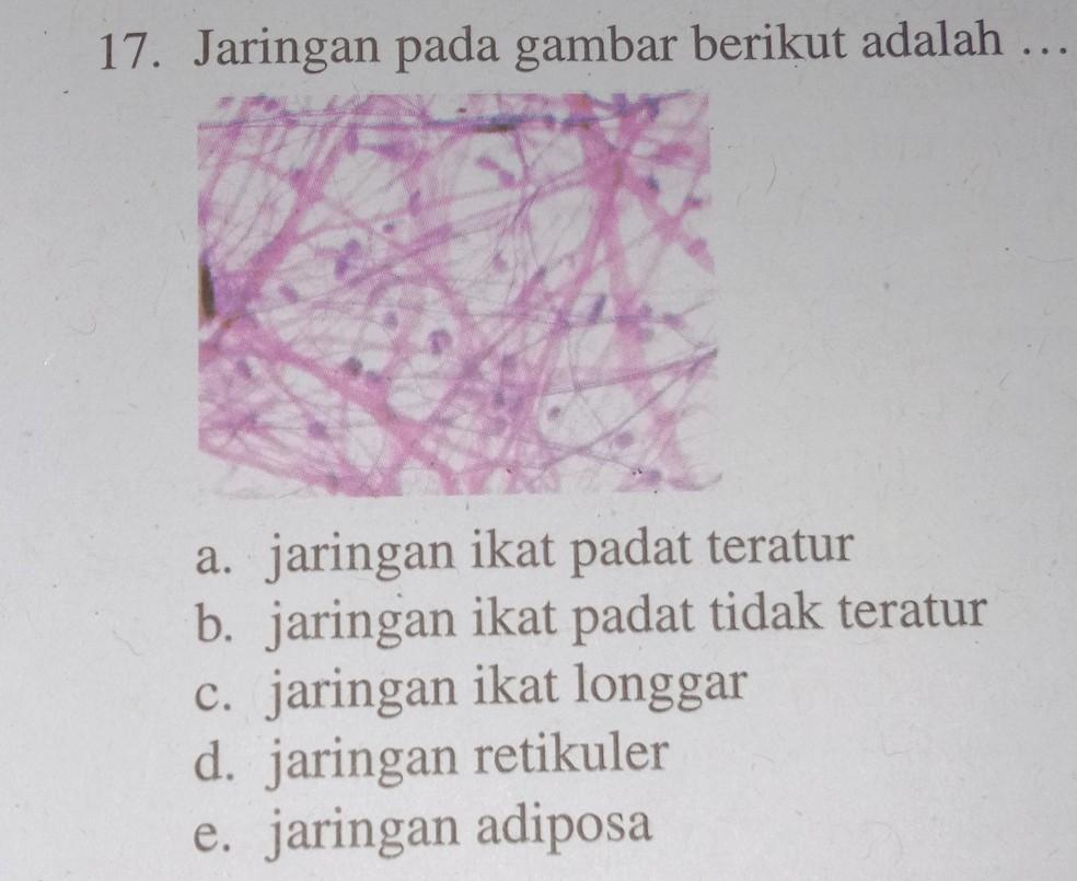 Detail Contoh Jaringan Ikat Longgar Nomer 34