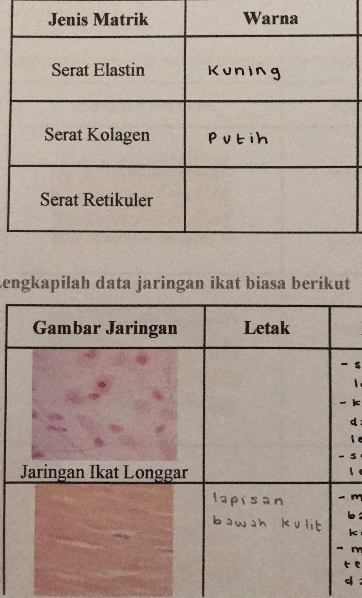 Detail Contoh Jaringan Ikat Longgar Nomer 52