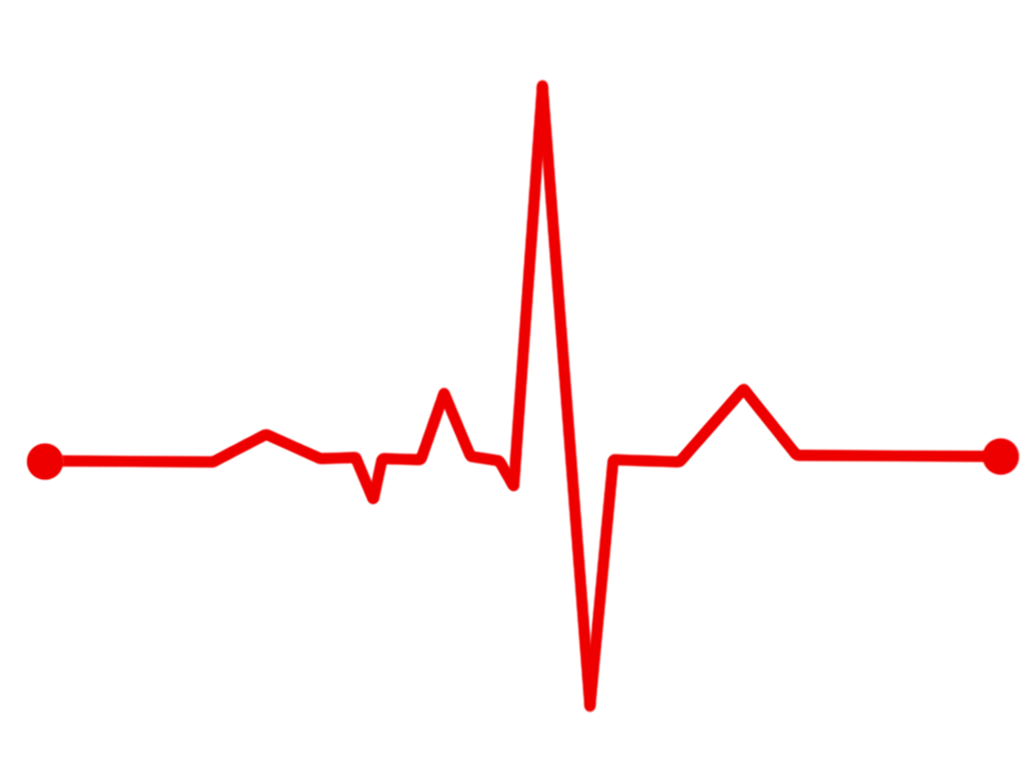 Detail Ekg Graphic Nomer 17