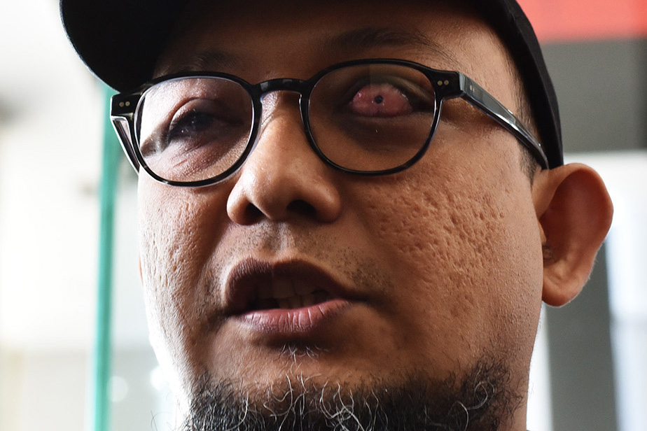 Detail Gambar Infeksi Mata Nomer 27