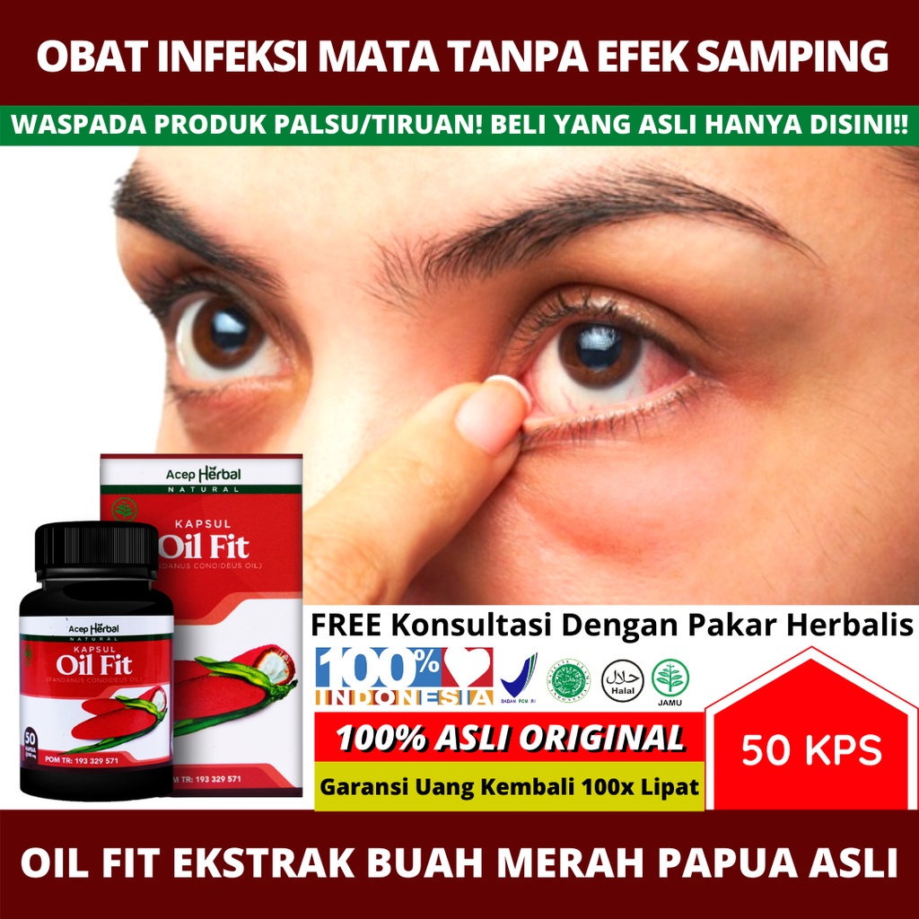 Detail Gambar Infeksi Mata Nomer 35