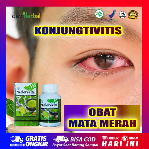 Detail Gambar Infeksi Mata Nomer 44