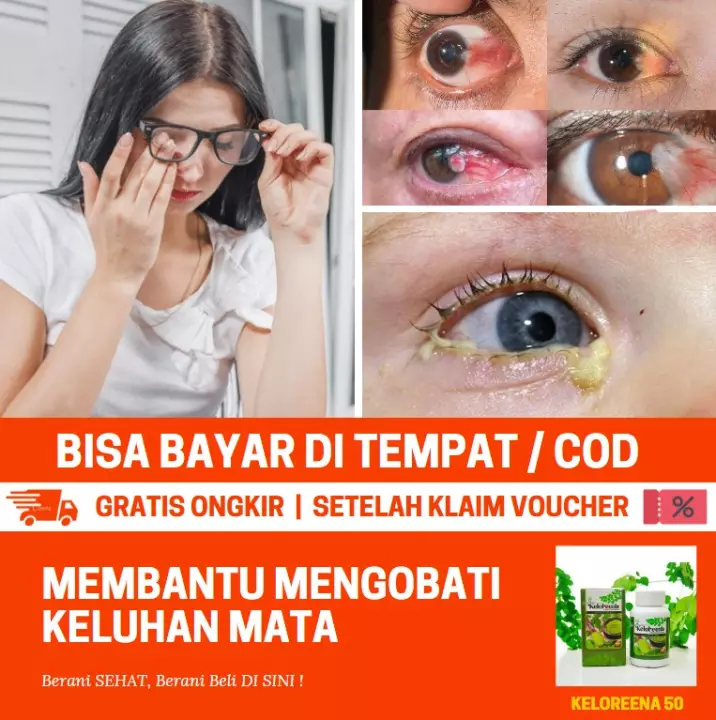 Detail Gambar Infeksi Mata Nomer 47
